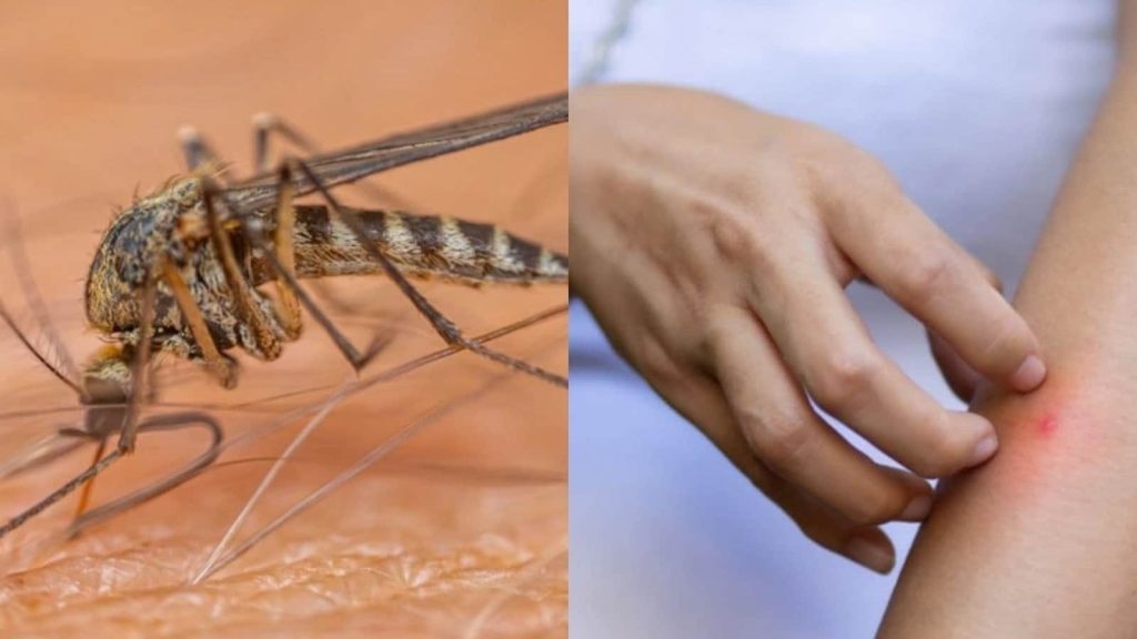 मलेरिया एक प्लास्मोडियम परजीवी द्वारा फैलता है, जो मादा एनाफिलीज मच्छरों...