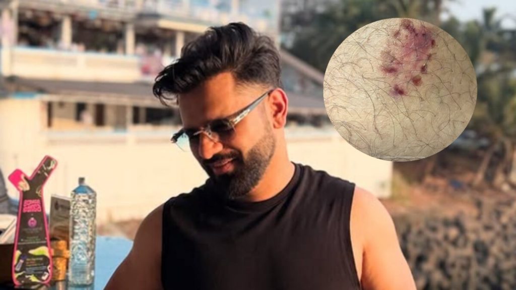 बिग बॉस 14 के फाइनलिस्ट राहुल वैद्य ने सुप्रीम कोर्ट के उस निर्णय का समर्थन...