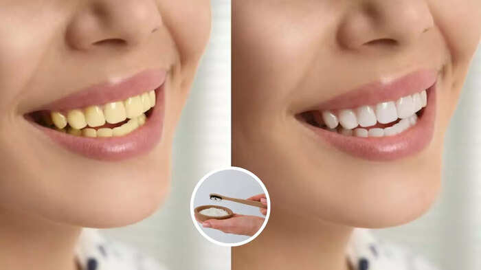 ક્યારેય સડકો નહીં, દાંત, યલોઝનેસ અને મોંની ગંધથી છૂટકારો મેળવશે, ઘરેથી છૂટકારો મેળવશે … Toothpaste at home