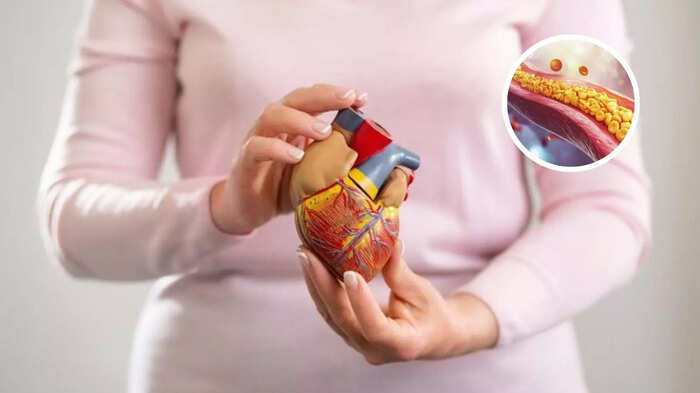 શું તમે પણ ખરાબ કોલેસ્ટરોલ, હૃદયનો દુશ્મન સમજો છો? જાણો કે તેનું કામ શું છે અને … what is ldl and why its bad for health know how to reduce bad cholesterol easily