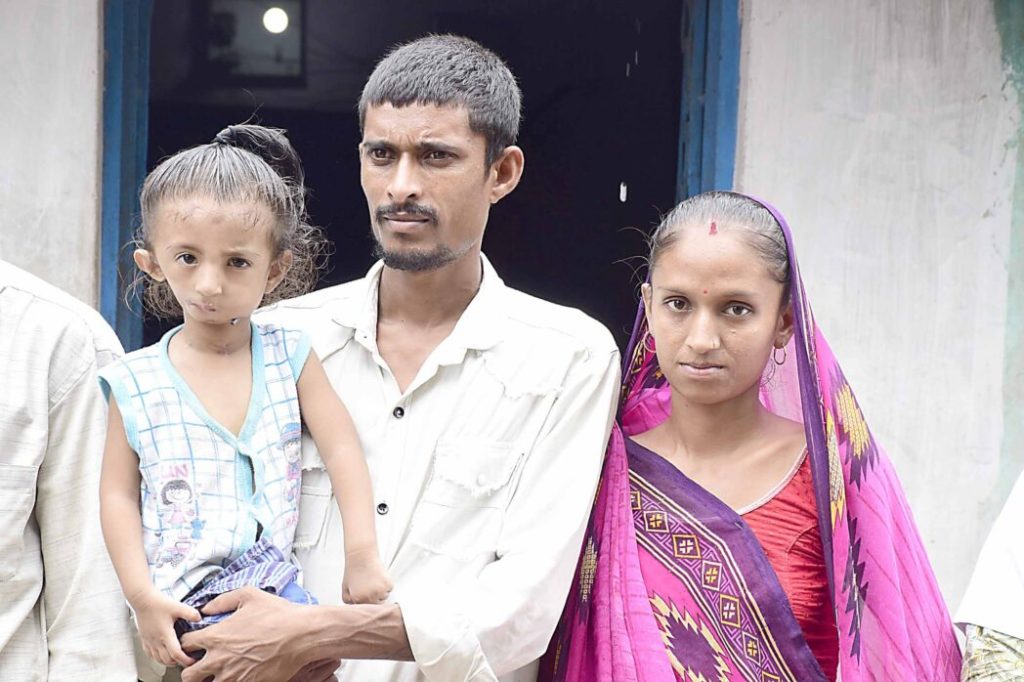 પોઈચા ગામના અઢી વર્ષના જયદેવ માટે RBSKની ટીમ બની વિઘ્નહર્તા