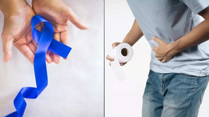 સ્ટૂલમાં થોડું લોહી, કબજિયાત, ઝાડા ન લો, કોલોન કેન્સર સૂચવવામાં આવી શકે છે, … Colon Cancer symptom