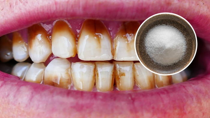 દાંત કેવી રીતે સાફ કરવું: પીળા દાંતમાંથી લોહી, સુગંધિત શ્વાસ? ડો. રોબિને 1 મહિનામાં કહ્યું … fitkari toothpaste for teeth cleaning