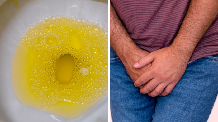 પુરુષ સાવચેત! પેશાબની ધાર ઓછી થાય છે, તૂટક તૂટક આવે છે? આ કેન્સર શરૂ થયું છે, … prostate cancer signs in hindi