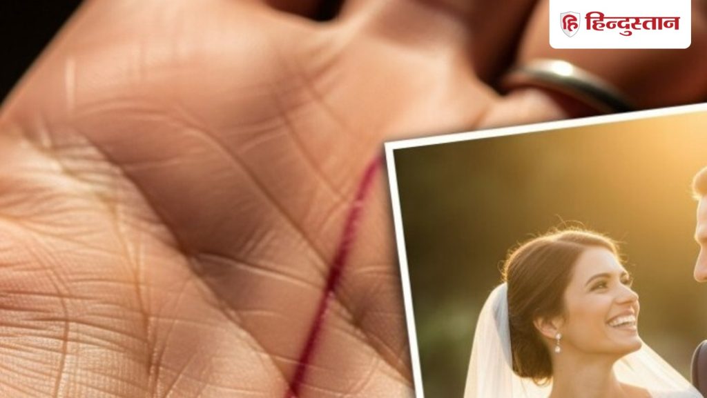 हस्तरेखा: ऐसी भाग्य रेखा है तो शादी के बाद होता है...