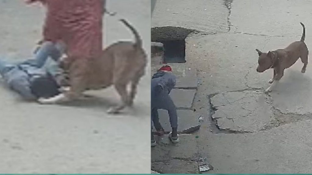 दिल्ली में पिटबुल ने 6 साल के बच्चे का कान नोंचा, शरीर से अलग हुआ...