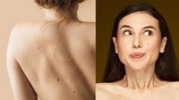 પોસ્ટ્સ