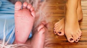 ભાગ્ય જણાવતા છછુંદર, જાણો તમારા અંગૂઠા પર કયું નિશાન દર્શાવે છે… Post