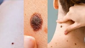 પોસ્ટ્સ