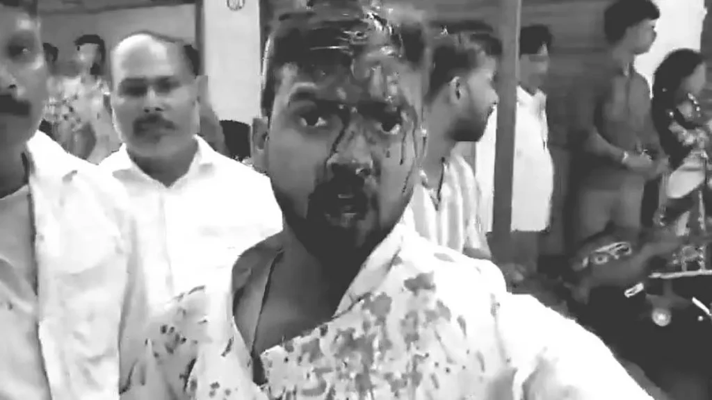 UP: शादी की रात दुल्हन के कथित हमले में दूल्हा घायल