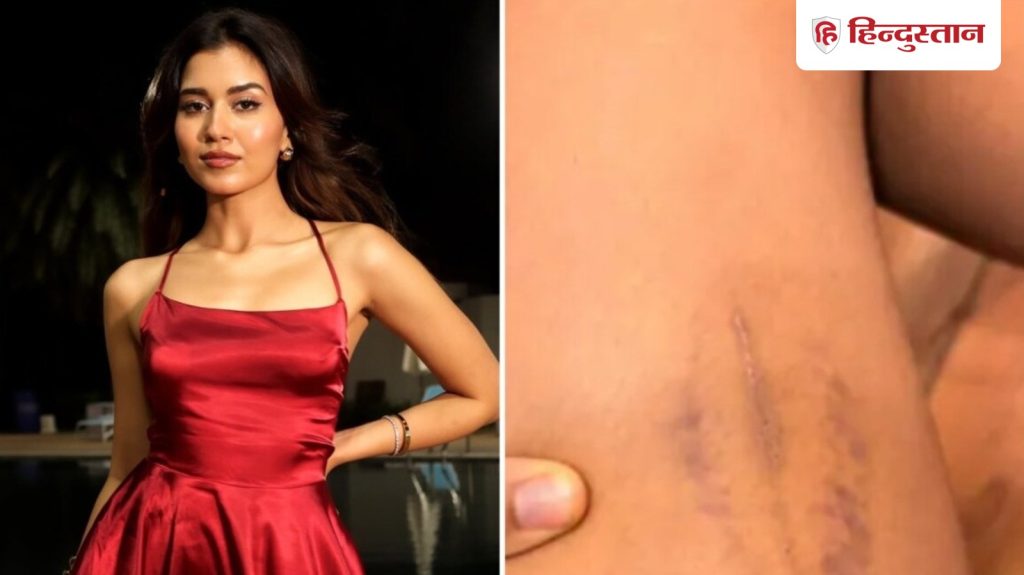 स्पिल्ट्सविला X6: सैंडल की हील से पीटा, इतने थप्पड़ मारे कि होठों से… दीक्षा...